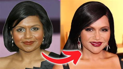 mindy kaling plastic surgery|Mindy Kaling Before and After Plastic Surgery: Nose, Boob, Lips